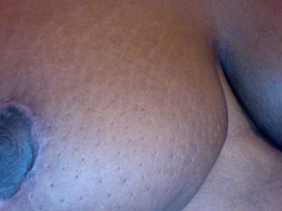 Normal Breast Texture 105