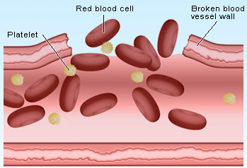 What are the symptoms of a low blood platelet count?