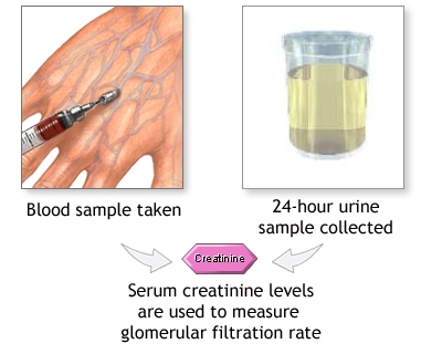 17 ketosteroids 24 hour urine