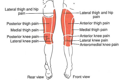 severe thigh muscle pain